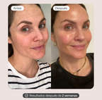 Set Varita Infinite Glow & Serum Activador