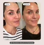 Set Varita & 2 Serum